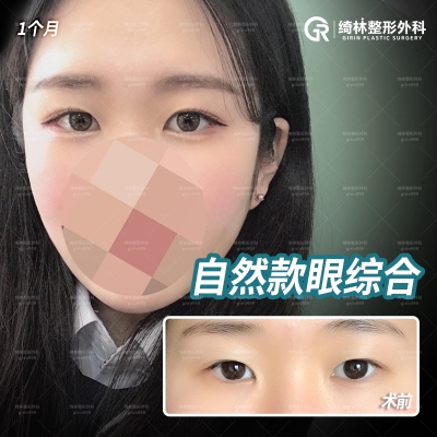 GIRIN Plastic Surgery. GIRIN aesthetic Clinic — Korea cost, reviews & before-after | MISOODA