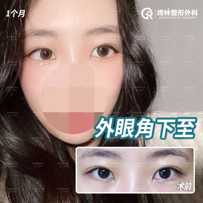 GIRIN Plastic Surgery. GIRIN aesthetic Clinic — Korea cost, reviews & before-after | MISOODA