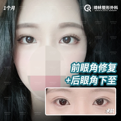 GIRIN Plastic Surgery. GIRIN aesthetic Clinic — Korea cost, reviews & before-after | MISOODA