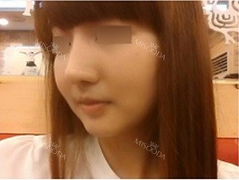 GNG Hospital, Reviews, Images, Promotions — Korea cost, reviews & before-after | MISOODA