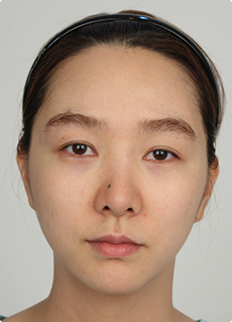 Faceline Plastic Surgery, Reviews,Images,Promotions — Korea cost, reviews & before-after | MISOODA
