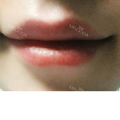 GIRIN Plastic Surgery. GIRIN aesthetic Clinic — Korea cost, reviews & before-after | MISOODA