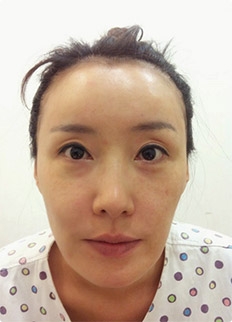 GIRIN Plastic Surgery. GIRIN aesthetic Clinic — Korea cost, reviews & before-after | MISOODA