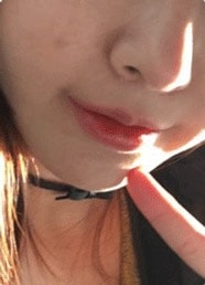 Deesse Plastic Surgery, Reviews,Images, Promotions — Korea cost, reviews & before-after | MISOODA