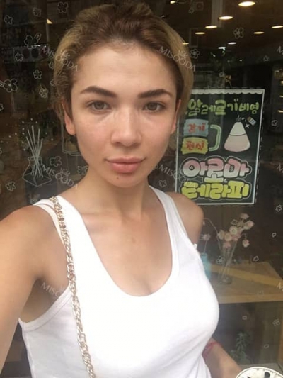 JK Plastic Surgery, Reviews, Images, Promotions — Korea cost, reviews & before-after | MISOODA
