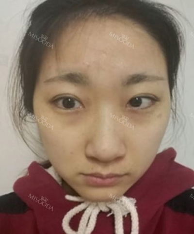 Banobagi Plastic Surgery,Reviews,Images, Promotions, MISOODA — Korea cost, reviews & before-after | MISOODA