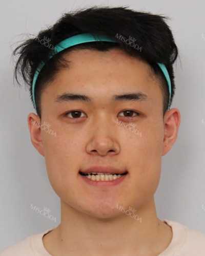 Banobagi Plastic Surgery,Reviews,Images, Promotions, MISOODA — Korea cost, reviews & before-after | MISOODA