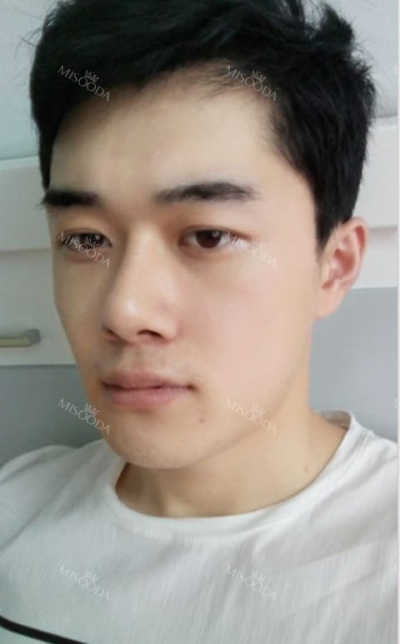 Banobagi Plastic Surgery,Reviews,Images, Promotions, MISOODA — Korea cost, reviews & before-after | MISOODA