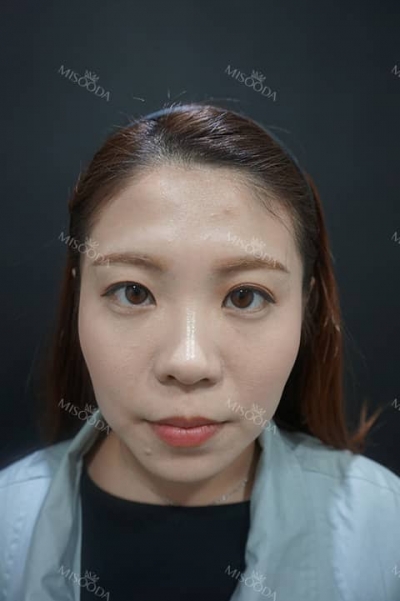 Glow Voyage – MISooda K-Beauty Signature for KTF 2025 — Korea cost, reviews & before-after | MISOODA