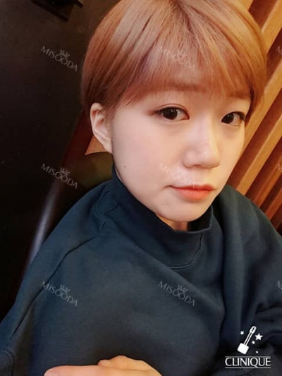 JK Plastic Surgery, Reviews, Images, Promotions — Korea cost, reviews & before-after | MISOODA