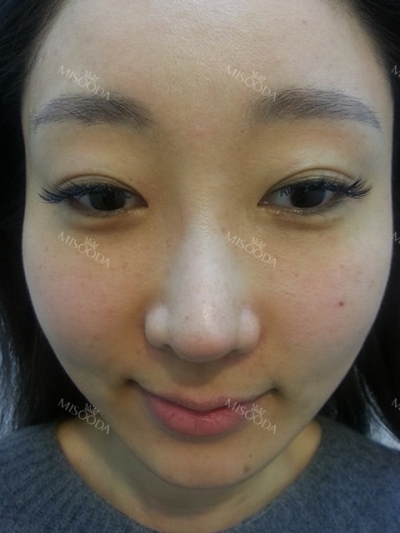 Glow Voyage – MISooda K-Beauty Signature for KTF 2025 — Korea cost, reviews & before-after | MISOODA