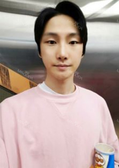 Deesse Plastic Surgery, Reviews,Images, Promotions — Korea cost, reviews & before-after | MISOODA