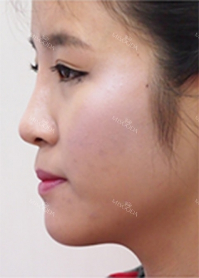 GNG Hospital, Reviews, Images, Promotions — Korea cost, reviews & before-after | MISOODA