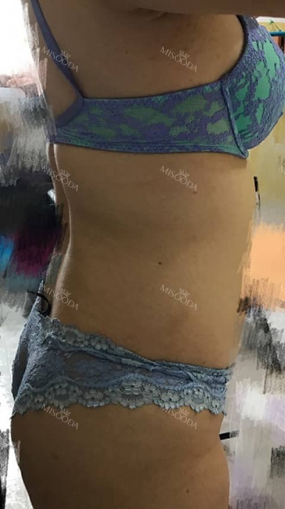 Seoul 365mc Liposuction,Reviews,Images, Promotions — Korea cost, reviews & before-after | MISOODA