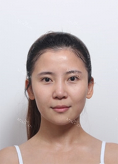 Deesse Plastic Surgery, Reviews,Images, Promotions — Korea cost, reviews & before-after | MISOODA