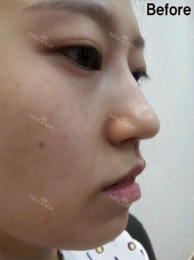 GIRIN Plastic Surgery. GIRIN aesthetic Clinic — Korea cost, reviews & before-after | MISOODA