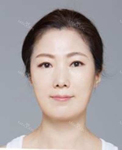 Glow Voyage – MISooda K-Beauty Signature for KTF 2025 — Korea cost, reviews & before-after | MISOODA