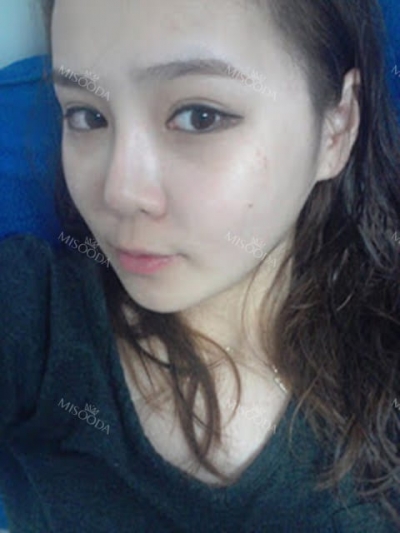 GIRIN Plastic Surgery. GIRIN aesthetic Clinic — Korea cost, reviews & before-after | MISOODA