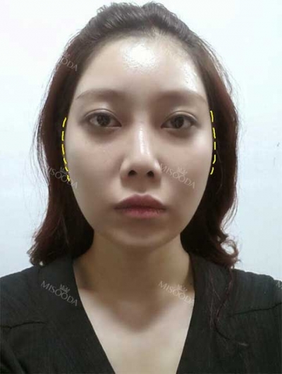 GIRIN Plastic Surgery. GIRIN aesthetic Clinic — Korea cost, reviews & before-after | MISOODA