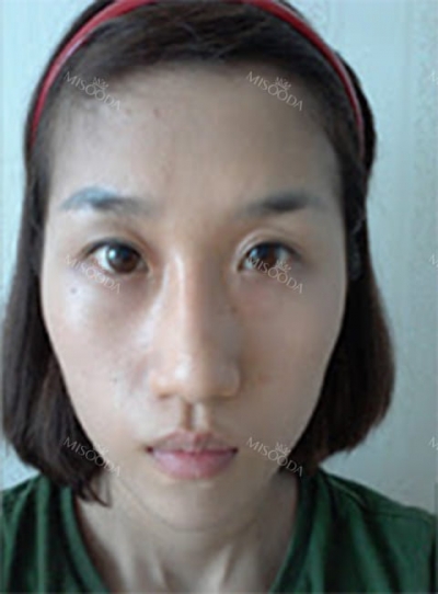 GIRIN Plastic Surgery. GIRIN aesthetic Clinic — Korea cost, reviews & before-after | MISOODA