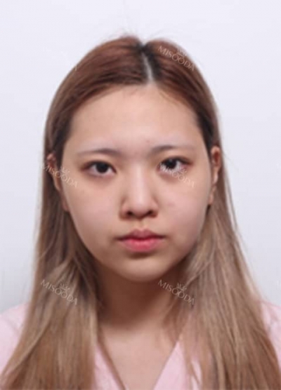 Deesse Plastic Surgery, Reviews,Images, Promotions — Korea cost, reviews & before-after | MISOODA