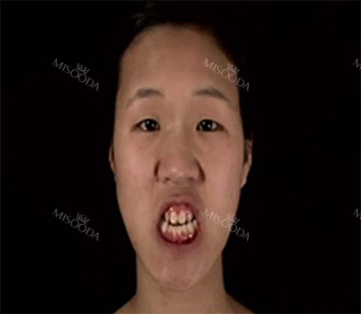 View Plastic Surgery, Reviews, Images, Promotions — Korea cost, reviews & before-after | MISOODA