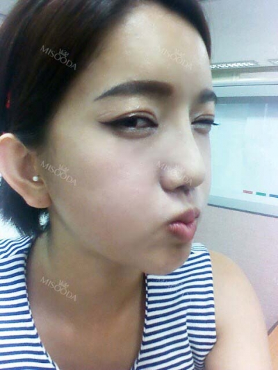View Plastic Surgery, Reviews, Images, Promotions — Korea cost, reviews & before-after | MISOODA