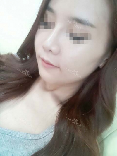 View Plastic Surgery, Reviews, Images, Promotions — Korea cost, reviews & before-after | MISOODA