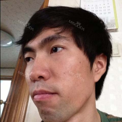View Plastic Surgery, Reviews, Images, Promotions — Korea cost, reviews & before-after | MISOODA
