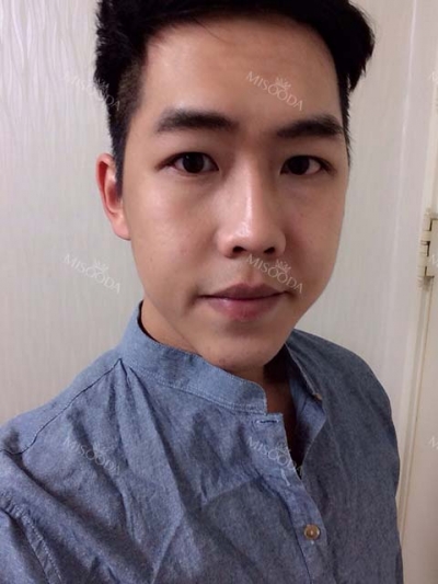 View Plastic Surgery, Reviews, Images, Promotions — Korea cost, reviews & before-after | MISOODA