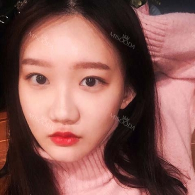 View Plastic Surgery, Reviews, Images, Promotions — Korea cost, reviews & before-after | MISOODA