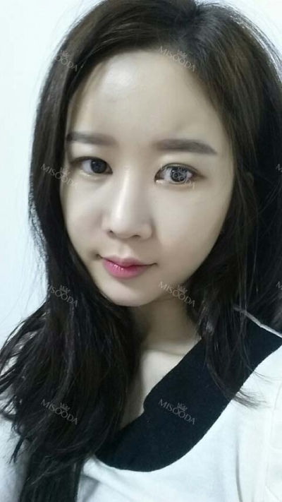 View Plastic Surgery, Reviews, Images, Promotions — Korea cost, reviews & before-after | MISOODA