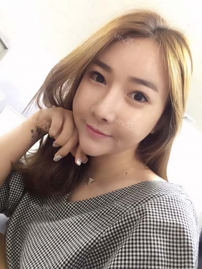 View Plastic Surgery, Reviews, Images, Promotions — Korea cost, reviews & before-after | MISOODA