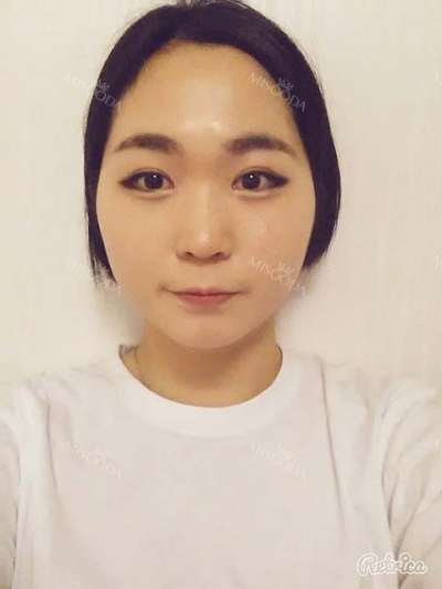 View Plastic Surgery, Reviews, Images, Promotions — Korea cost, reviews & before-after | MISOODA