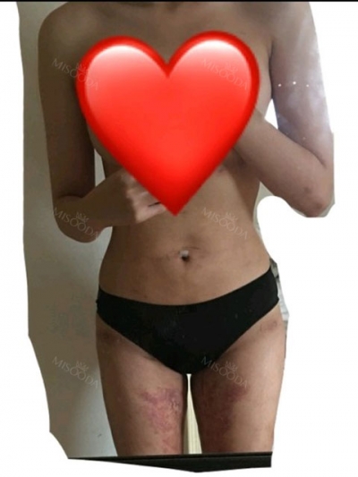 PRETTY BODY CLINIC,Reviews,Images, Promotions — Korea cost, reviews & before-after | MISOODA