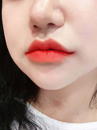 PRETTY BODY CLINIC,Reviews,Images, Promotions — Korea cost, reviews & before-after | MISOODA