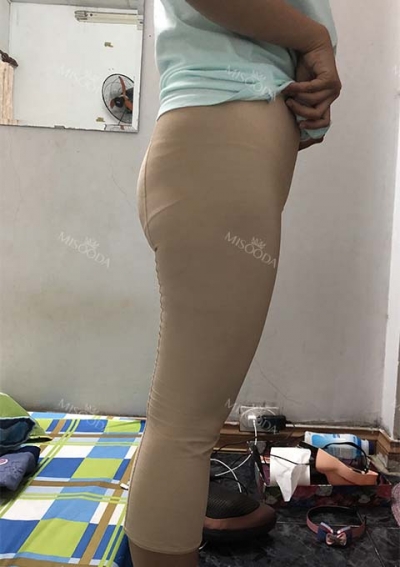 PRETTY BODY CLINIC,Reviews,Images, Promotions — Korea cost, reviews & before-after | MISOODA