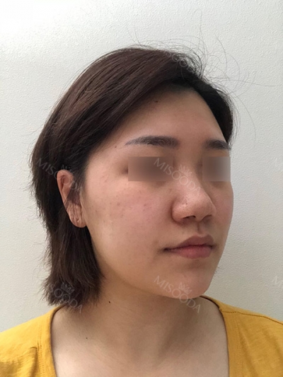BoCelle Aesthetic Medical Group, Reviews, Images, Promotions — Korea cost, reviews & before-after | MISOODA