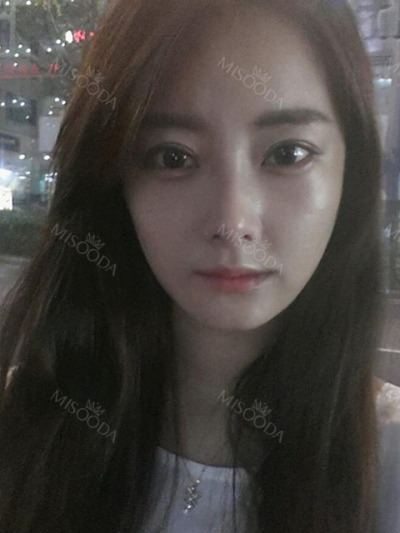 Jewelry Plastic Surgery,Reviews,Images, Promotions — Korea cost, reviews & before-after | MISOODA