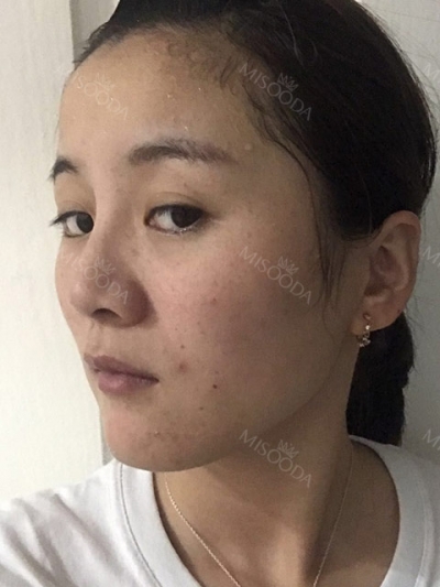 BoCelle Aesthetic Medical Group, Reviews, Images, Promotions — Korea cost, reviews & before-after | MISOODA