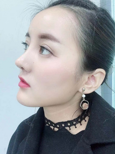 BoCelle Aesthetic Medical Group, Reviews, Images, Promotions — Korea cost, reviews & before-after | MISOODA