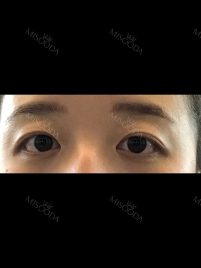 GIRIN Plastic Surgery. GIRIN aesthetic Clinic — Korea cost, reviews & before-after | MISOODA