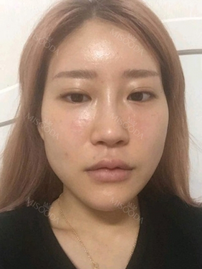 NANA Plastic Surgery,Reviews,Images, Promotions, MISOODA — Korea cost, reviews & before-after | MISOODA