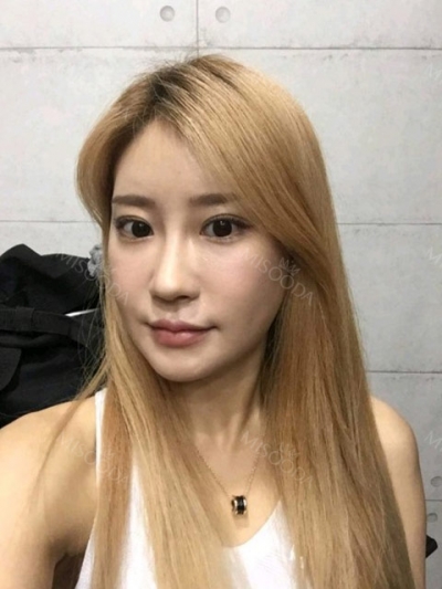 NANA Plastic Surgery,Reviews,Images, Promotions, MISOODA — Korea cost, reviews & before-after | MISOODA