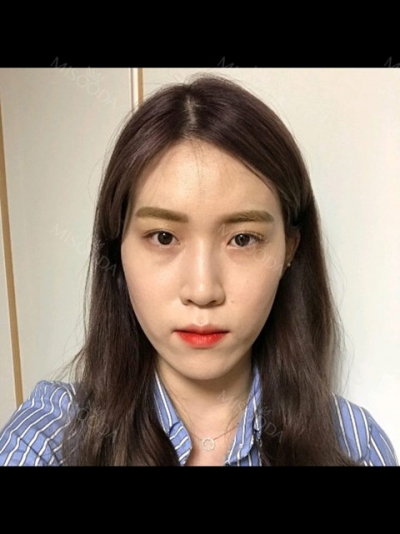 NANA Plastic Surgery,Reviews,Images, Promotions, MISOODA — Korea cost, reviews & before-after | MISOODA
