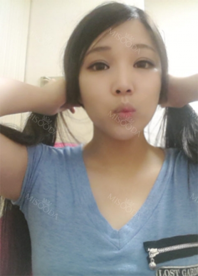 Apgujeongseoul Plastic Surgery,Reviews,Images, Promotion — Korea cost, reviews & before-after | MISOODA
