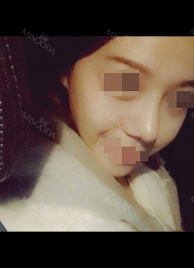 Hyundai Aesthetics, Reviews, Images, Promotions — Korea cost, reviews & before-after | MISOODA