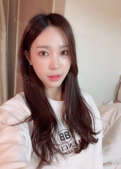 Hyundai Aesthetics, Reviews, Images, Promotions — Korea cost, reviews & before-after | MISOODA