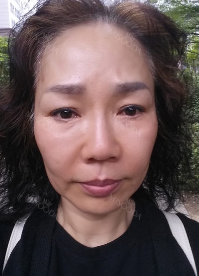 THE TIME Plastic Surgery & Dermatology — Korea cost, reviews & before-after | MISOODA