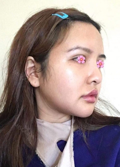 View Plastic Surgery, Reviews, Images, Promotions — Korea cost, reviews & before-after | MISOODA